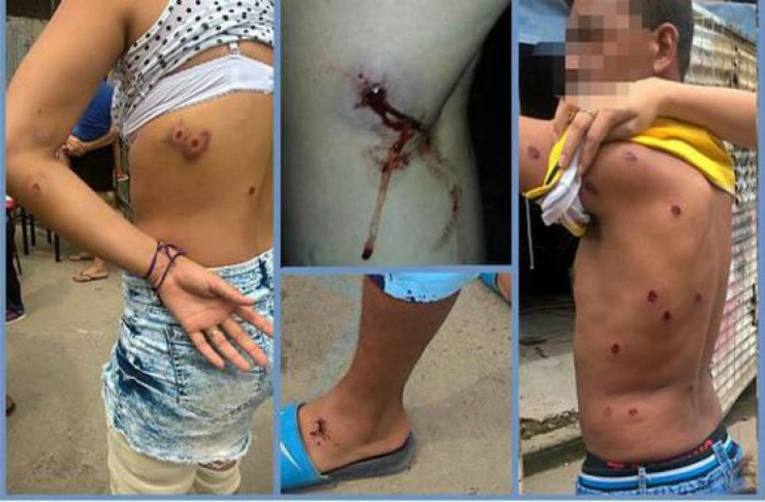 Photo of Testimonios de la represión a la murga: «Me tiraron al suelo para dispararme con una escopeta»