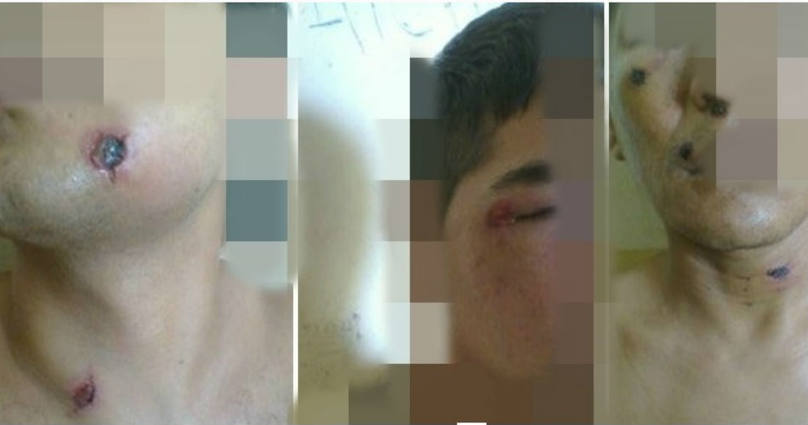 Photo of Golpean y torturan presos en Jujuy: recluso puede terminar paralítico