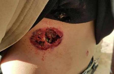 Photo of Represión y paro en Neuquén: Hubo heridos de bala de goma