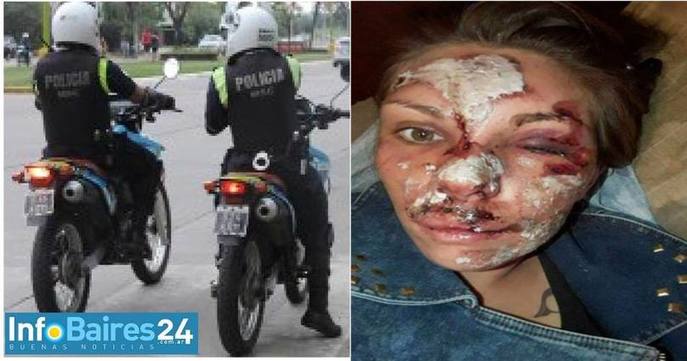 Photo of Policías de Chacabuco provocan graves heridas a una joven motociclista y huyen