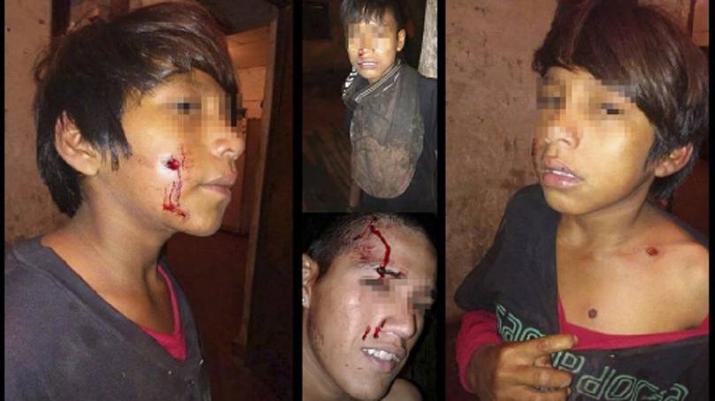 Photo of La verdad detrás del supuesto ataque a niños en Formosa