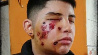 Photo of Allanamiento brutal: le disparan a la cara y le hacen perder un ojo