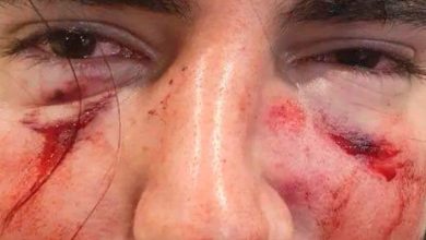 Photo of Córdoba: un grupo de rugbiers golpeó brutalmente a un joven de 18 años
