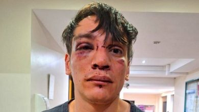 Photo of “¿Venís de la marcha?”: brutal golpiza de la Policía de la Ciudad a un abogado de DDHH