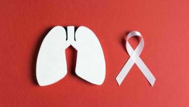 Photo of DÍA MUNDIAL DEL CÁNCER DE PULMÓN: alertan sobre el AUMENTO de CASOS