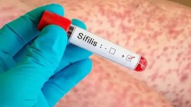Photo of LA SÍFILIS AVANZA: los casos se INCREMENTARON un 20,5% en Argentina