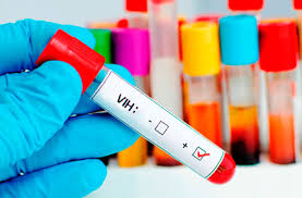 Photo of Diagnóstico temprano del VIH podría reducir muertes relacionadas con el SIDA