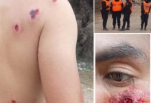 Photo of REPUDIO A LA BRUTAL REPRESIÓN CONTRA LA COMUNIDAD SANTA ROSA DE HUMAHUACA